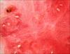 Watermelon, apparently seedless